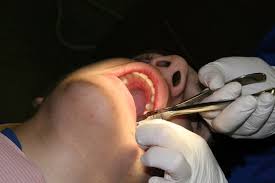 finanziamento-dentista
