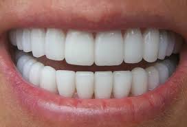 denti belli